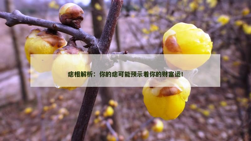 痣相解析:你的痣可能预示着你的财富运!