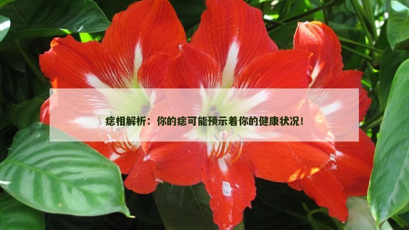 痣相解析:你的痣可能预示着你的健康状况!