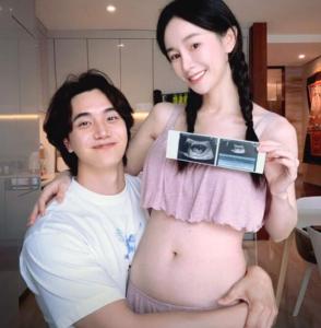 张檬自曝孕35周臀位绕颈 张檬老公是谁?